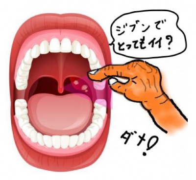 膿栓を取るのは危険