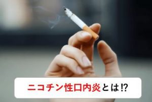 ニコチン性口内炎