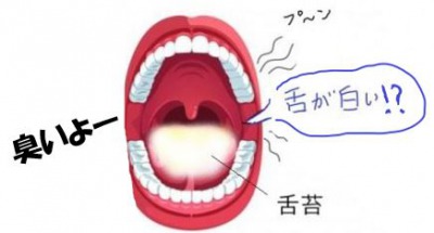 舌が白くて臭い