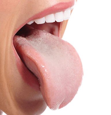 舌が白い