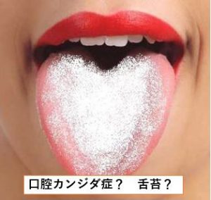 ベロが白いのは病気 舌について調べてわかったこととは