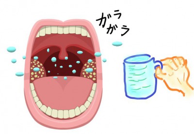 膿栓はうがいで取れる 喉うがいで口臭予防ができます