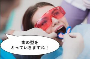 印象採得