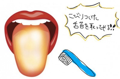 こびりついた舌苔を舌磨きで取る