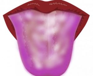 紫色の舌