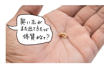 膿栓がよく出るのは体質?