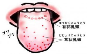 舌が白いと口臭になる 舌磨きのポイントは舌を傷つけないこと
