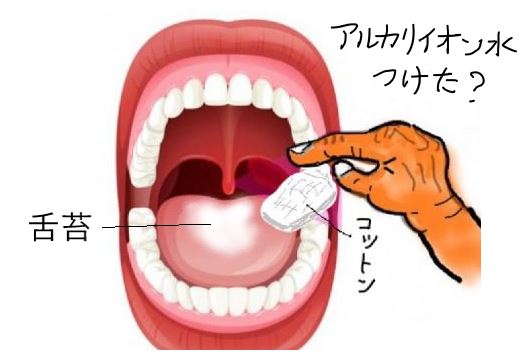 舌苔をアルカリイオン水のコットンでふき取る