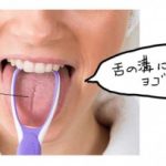 舌にひび割れ！溝状舌の原因と直し方
