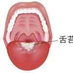 舌が白いと口臭になる！舌磨きのポイントは粘膜を傷つけないこと