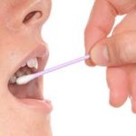 耳鼻咽喉科の病気による口臭：口臭原因の10％も